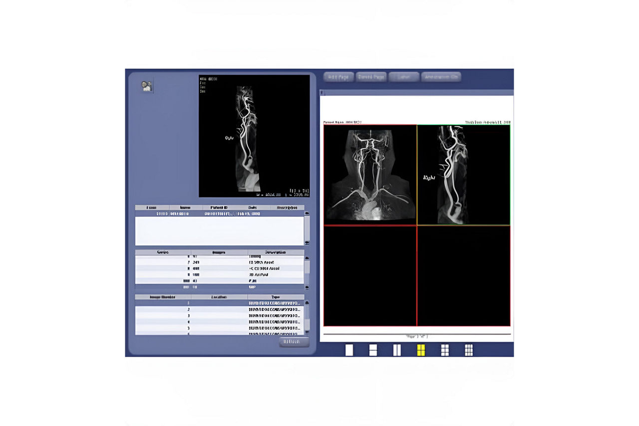 advanced-visualization-angiocard-HeroSticky-ci-en copy