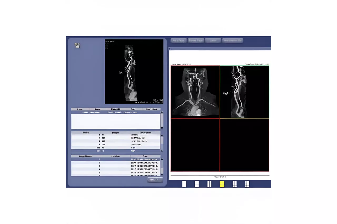 advanced-visualization-angiocard-HeroSticky-ci-en copy