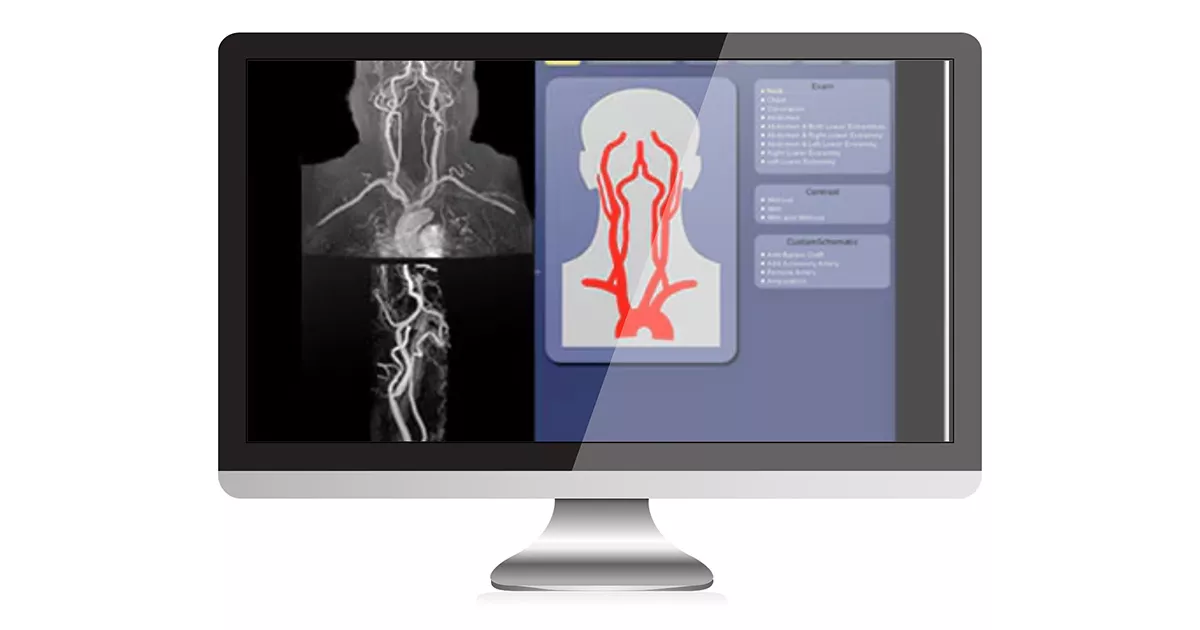 advanced-visualization-angiocard-OGImage-ci-en