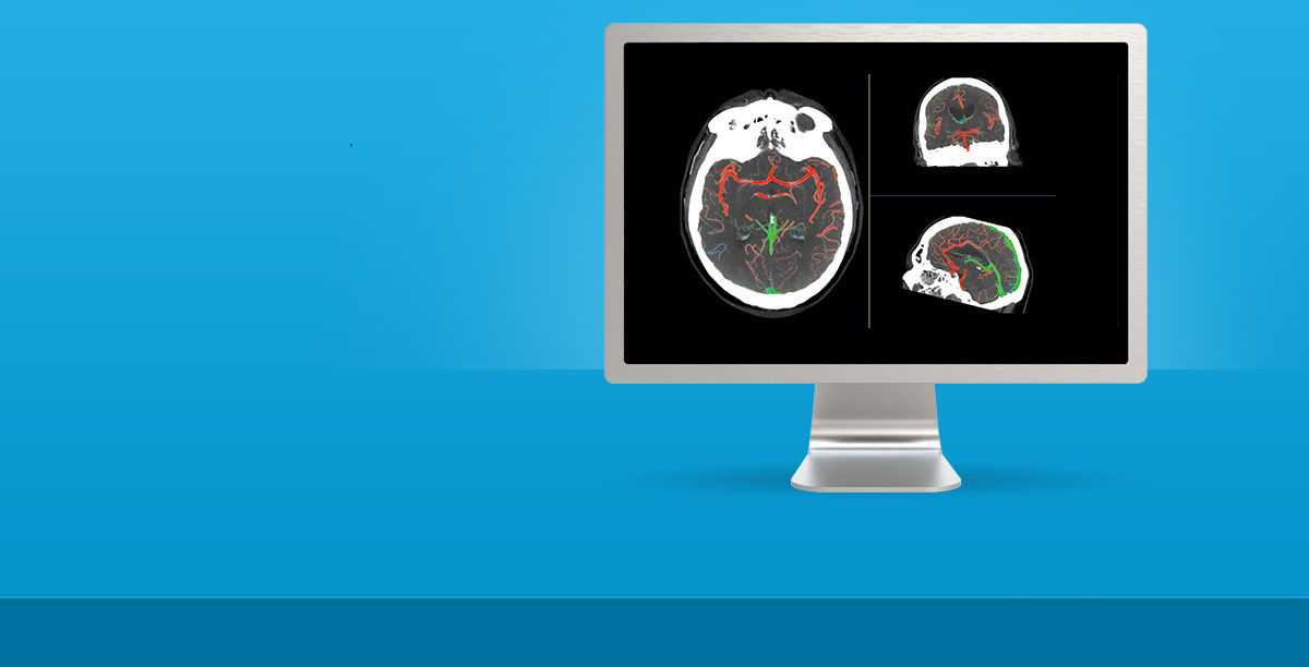advanced-visualization-applications-aw-faststroke-spotlight