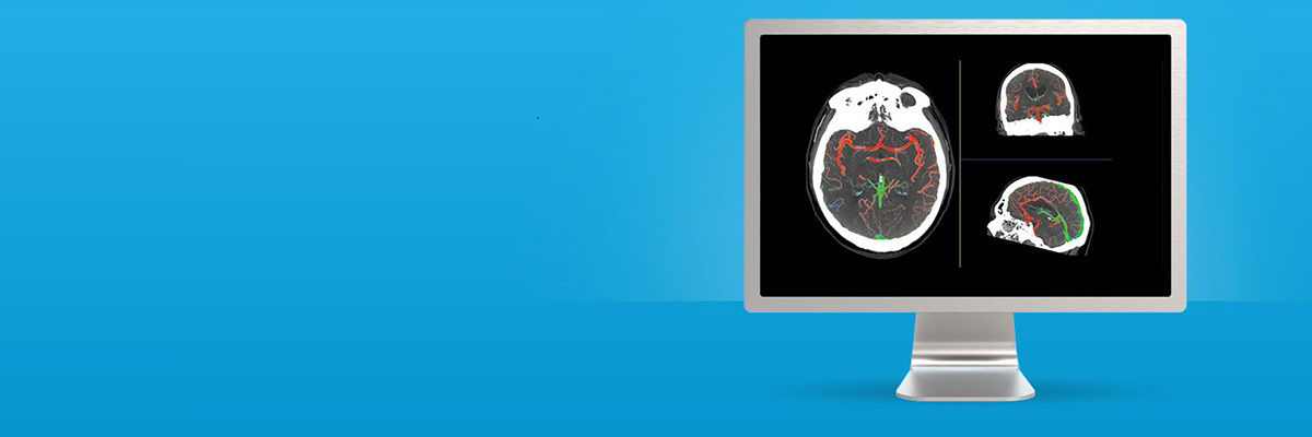 advanced-visualization-applications-aw-faststroke-spotlight-v1