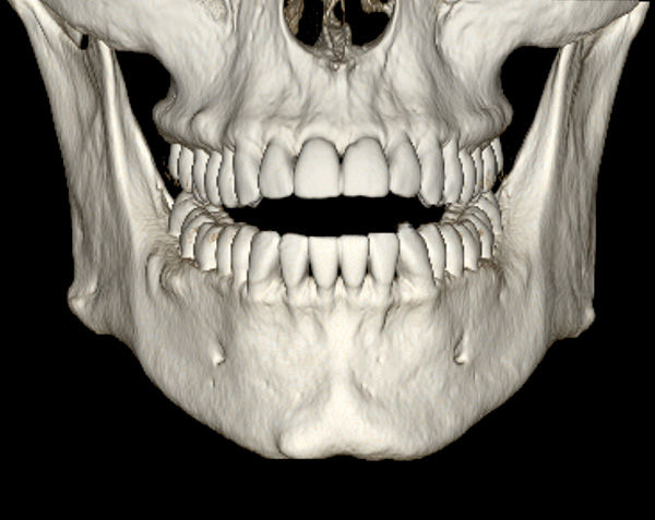 advanced-visualization-applications-dentascan-plus-aw-dentascan-overview