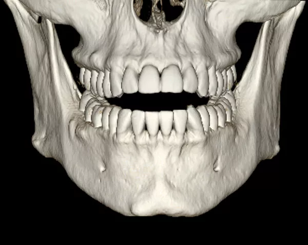 advanced-visualization-applications-dentascan-plus-aw-dentascan-overview