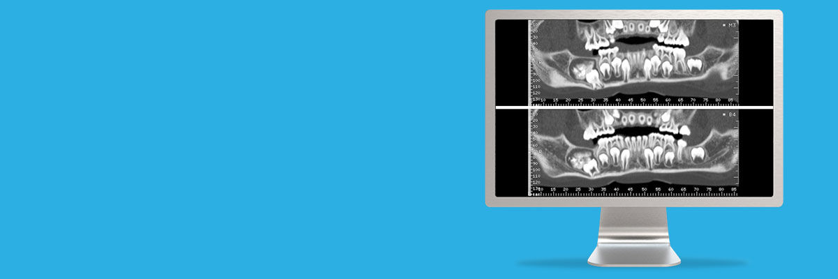 aw-dentascan-spotlight