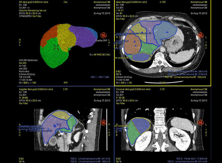 advanced-visualization-applications-hepatic-vcar-image-gallery-aw-hepatic-vcar-rev138i_jpg