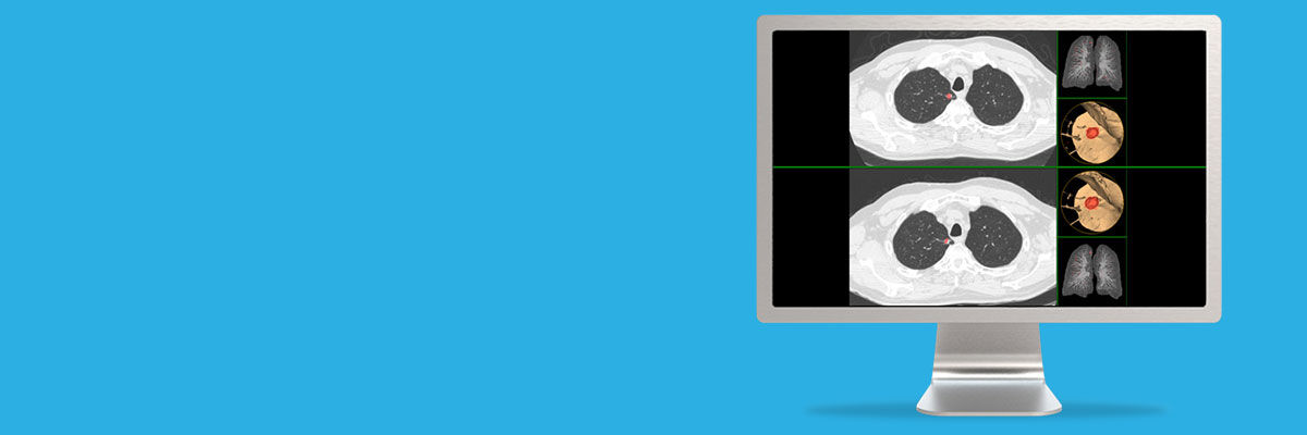 aw-lung-vcar-spotlight