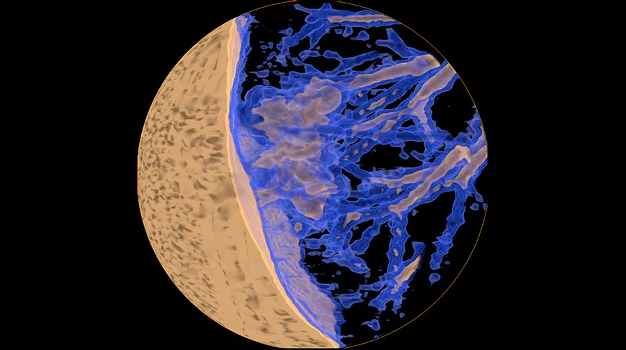 advanced-visualization-applications-lung-vcar-image-gallery-aw-lung-vcar-clinical5