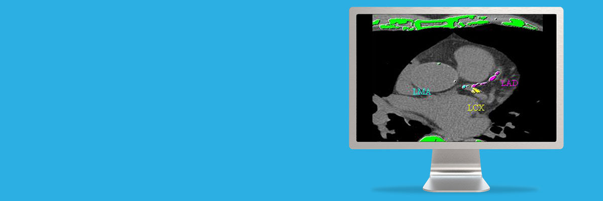 aw-smartscore-spotlight