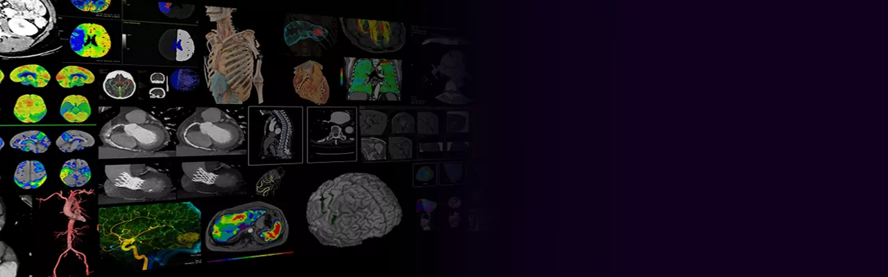advanced-visualization-apps-aw-one-promo-dynamic-img