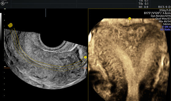 Advanced Volume Contrast Imaging