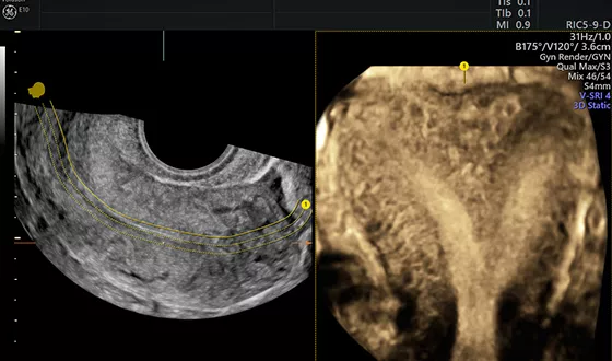 Advanced Volume Contrast Imaging