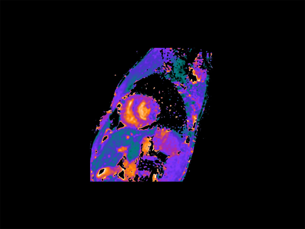 advancing-cardiac-magnetic-resonance-ArticleHero-ci-en