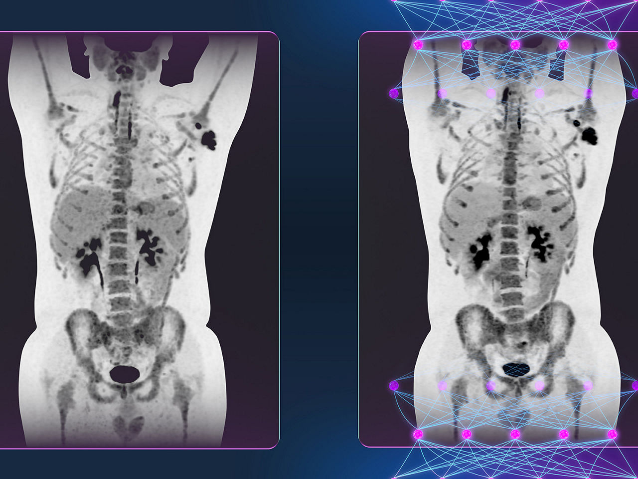 advancing-molecular-imaging-ArticleHero-ci-en