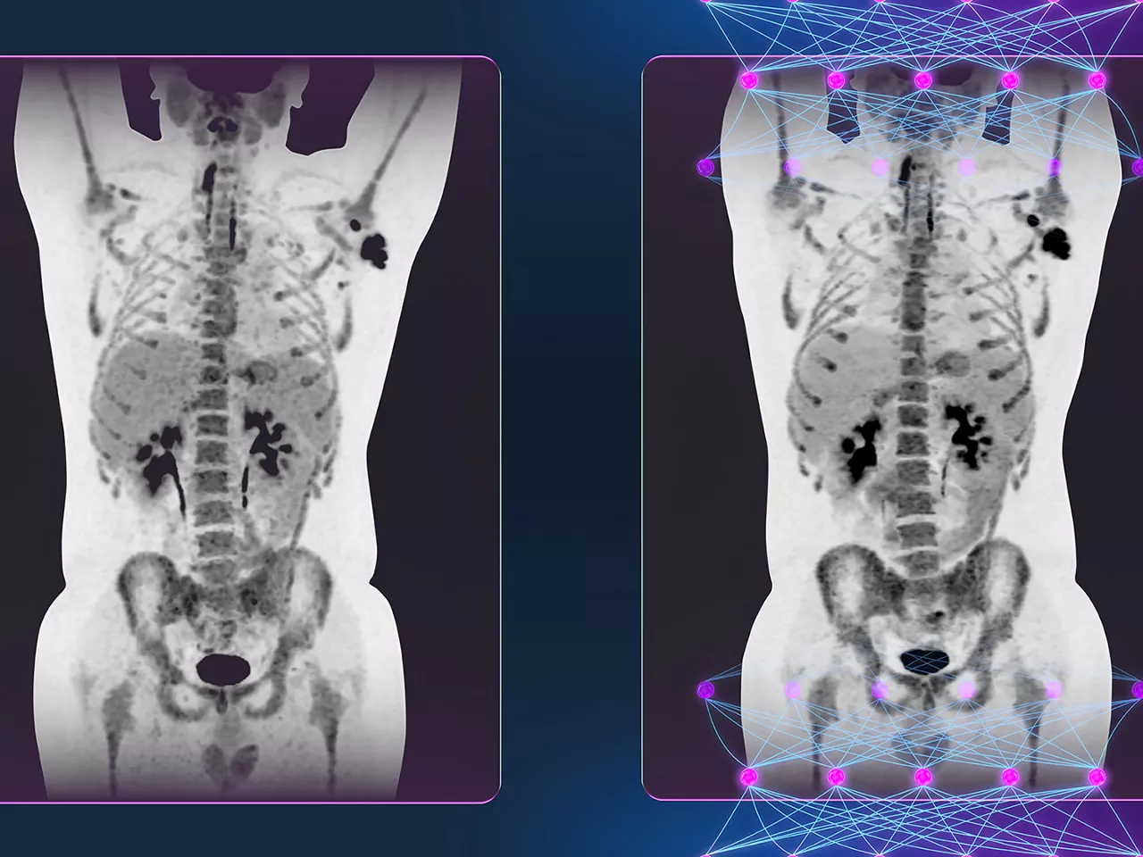 advancing-molecular-imaging-ArticleHero-ci-en