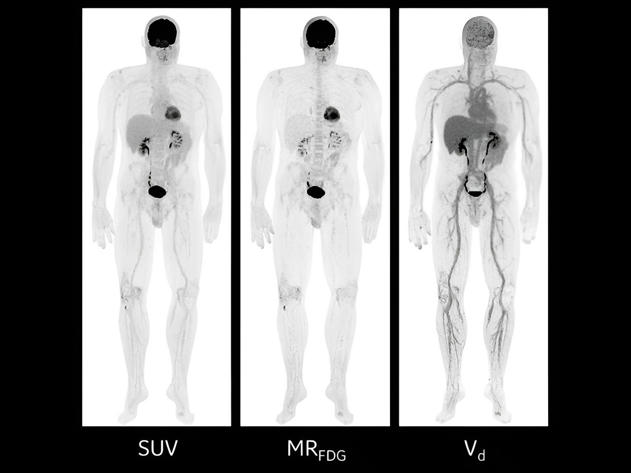 advancing-wholebody-dynamic-ArticleHero-ci-en