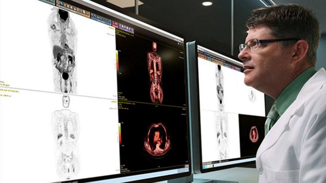 advantage-workstation-simplicity-ba-en