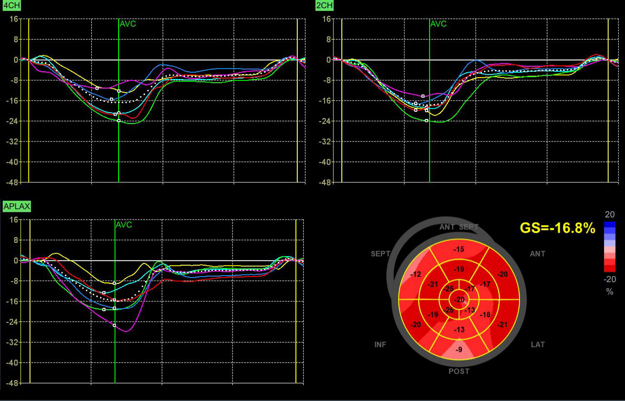 AFI VS70 R3
