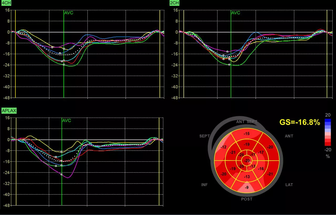 AFI VS70 R3