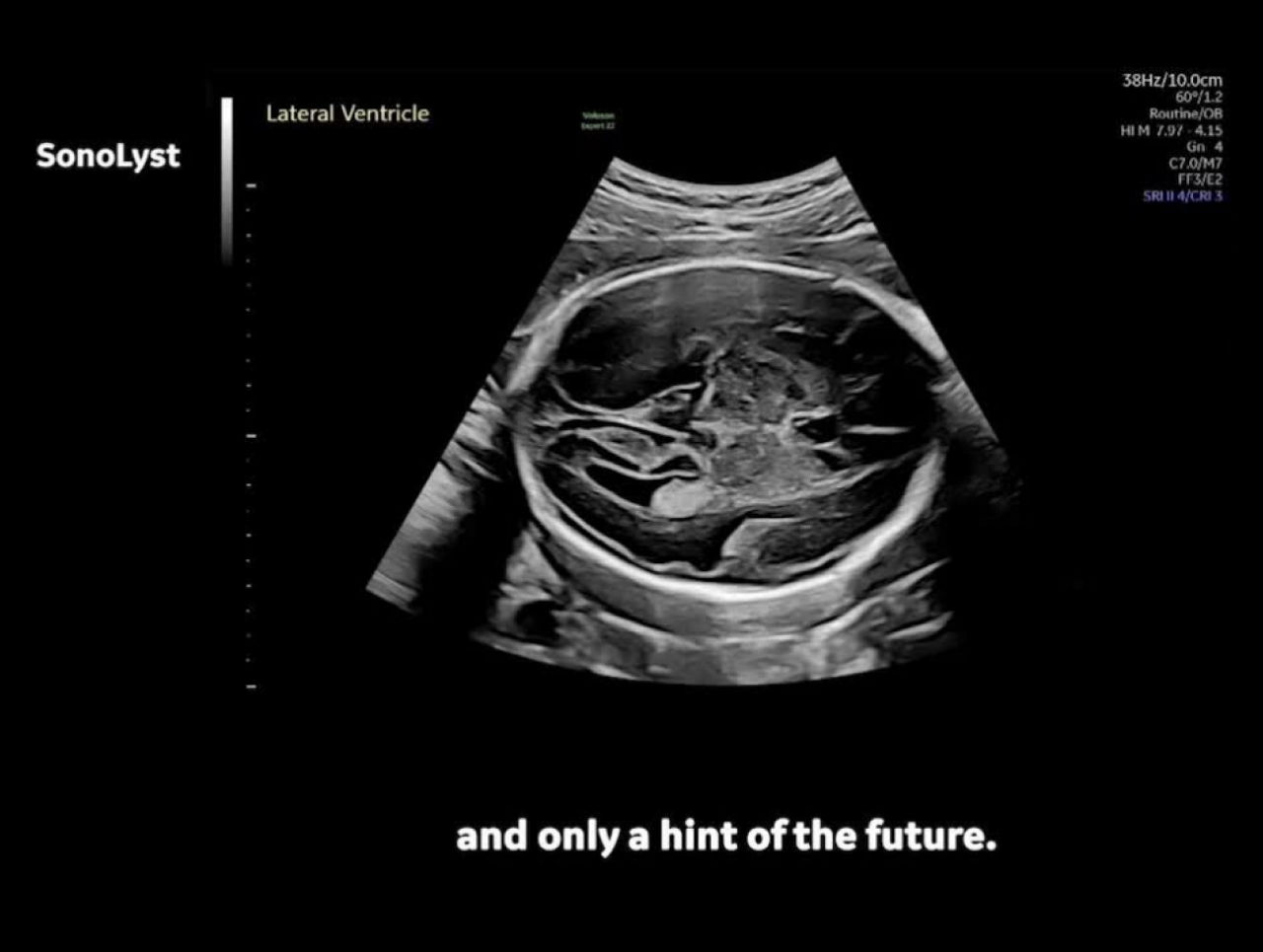 ai-enabled-ultrasound-systems-desktop