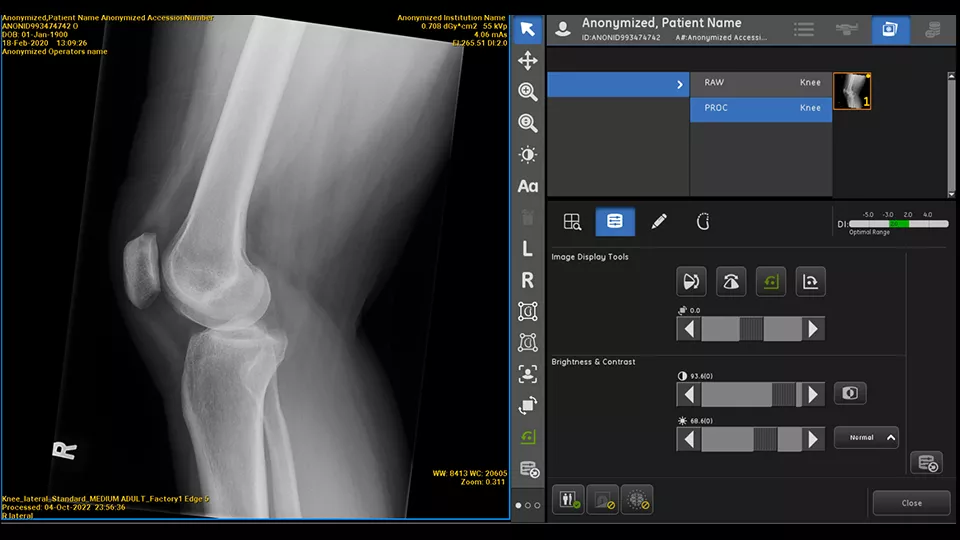 ai-in-x-ray-workflow-solutions-to-improve-care-delivery-jfif