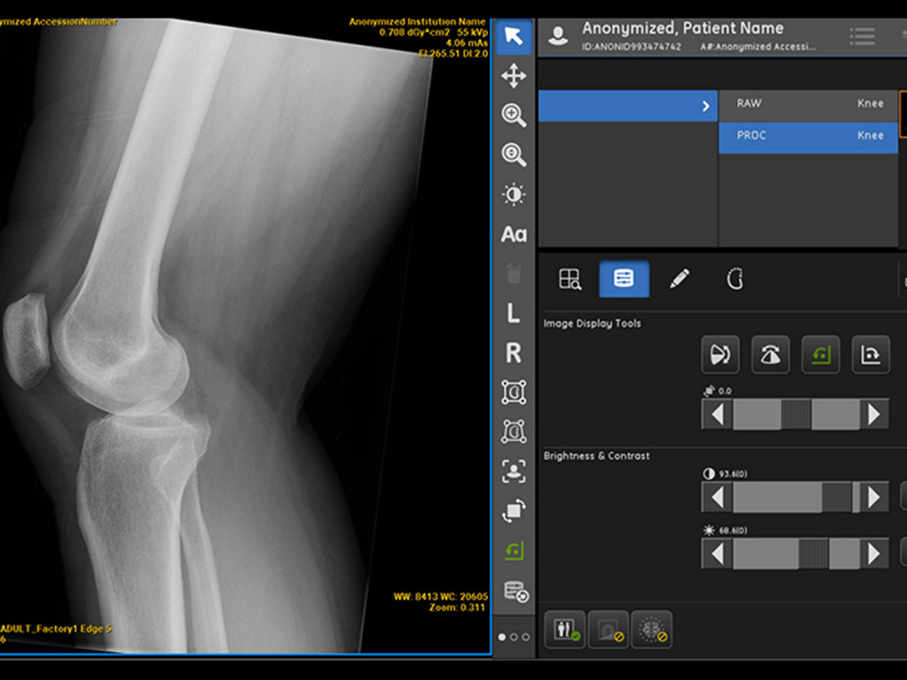 ai-in-xray-ArticleHero-ci-en