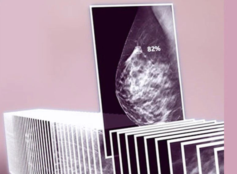 ai-lesion-detection-26-score-ba-en