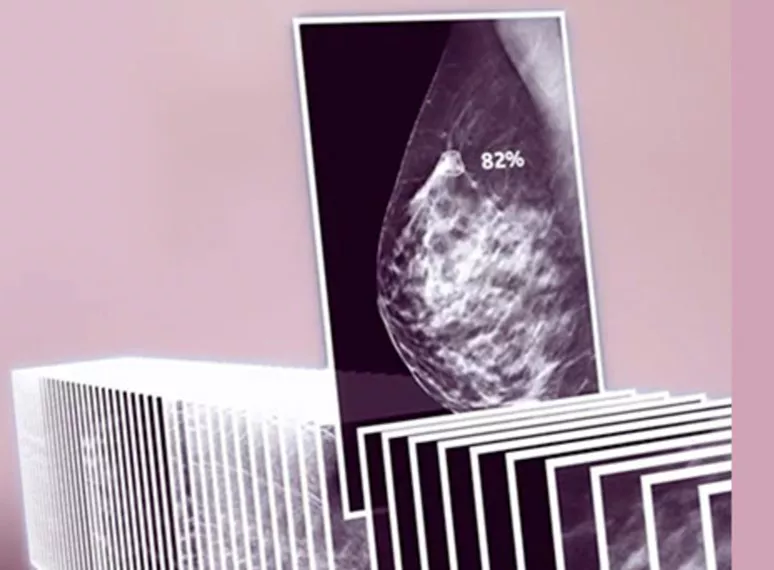 ai-lesion-detection-26-score-ba-en