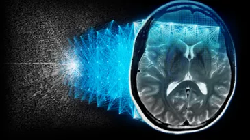 AIR Recon DL