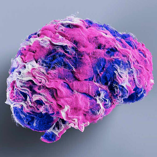 AIR Recon DL listing670