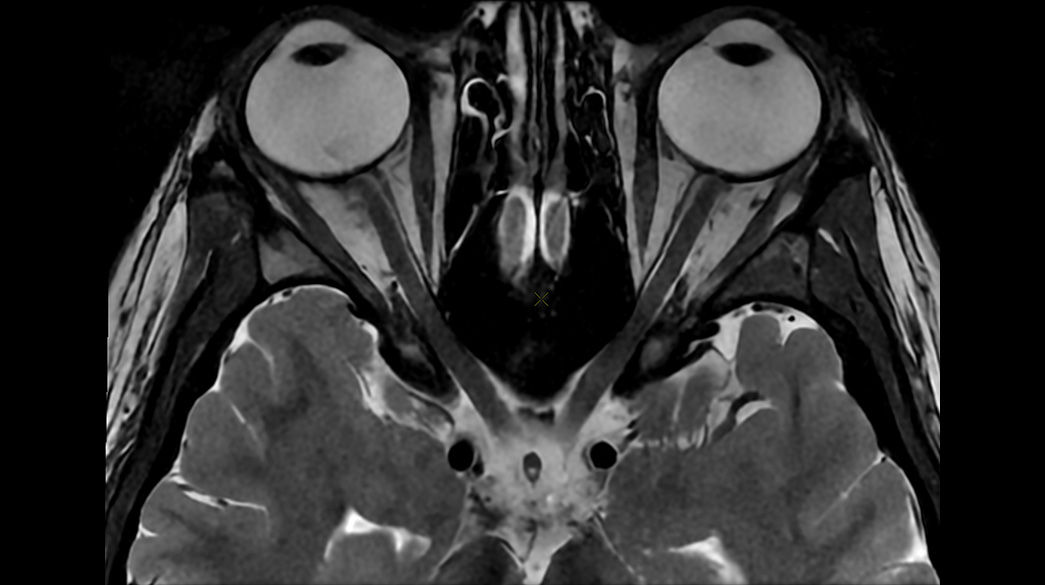 AIR-Recon-DL1040-x-585