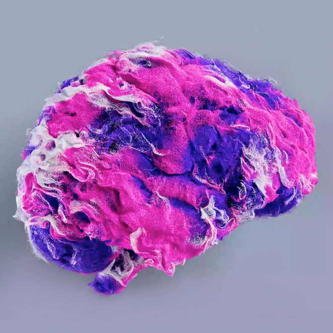 Image of AIR™ Recon DL