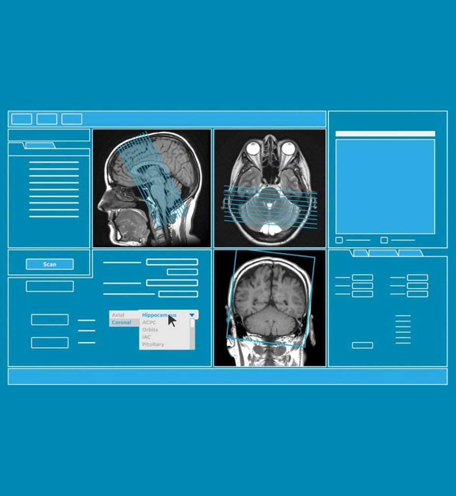 AIR-x feature hero automated MRI slice placement
