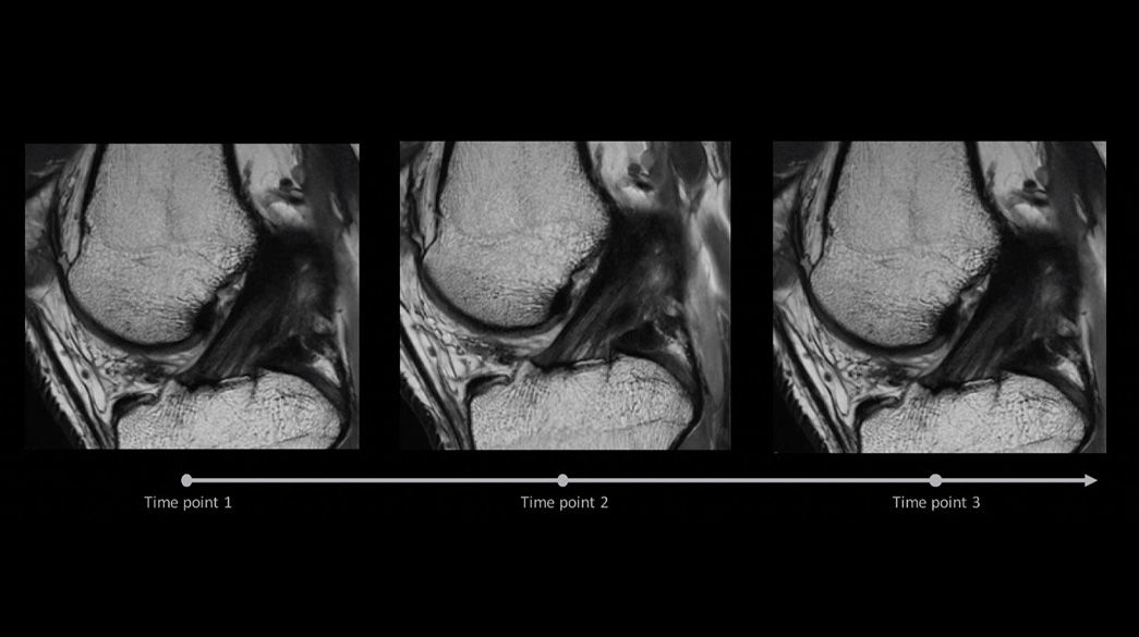 AIR-x-Knee1040-x-585