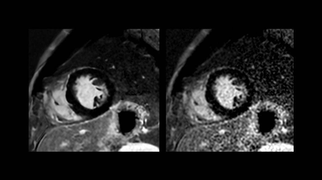 AIRRecon-DL1040-x-585
