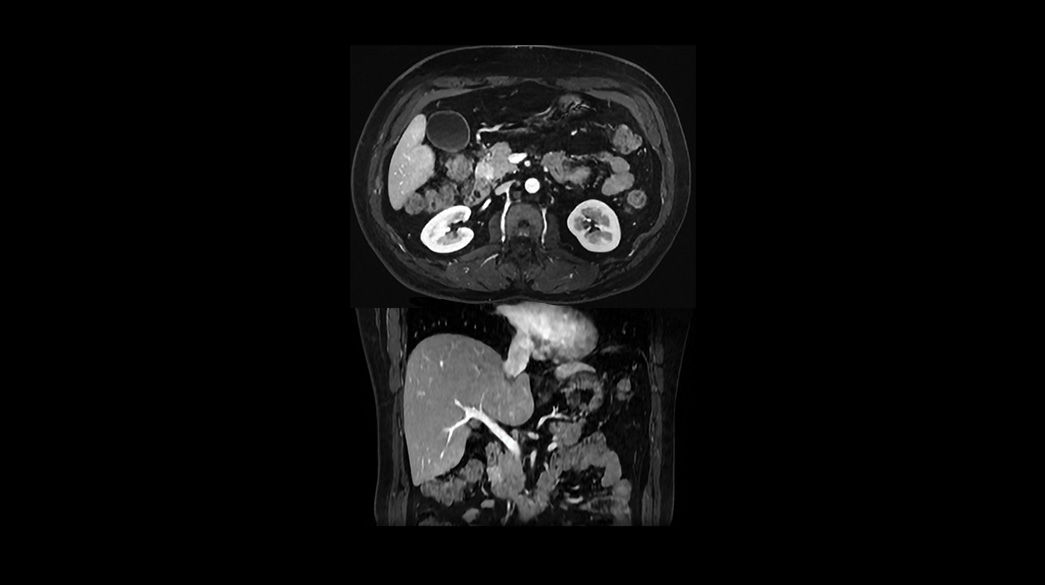 AIRRecon-DL1040-x-585