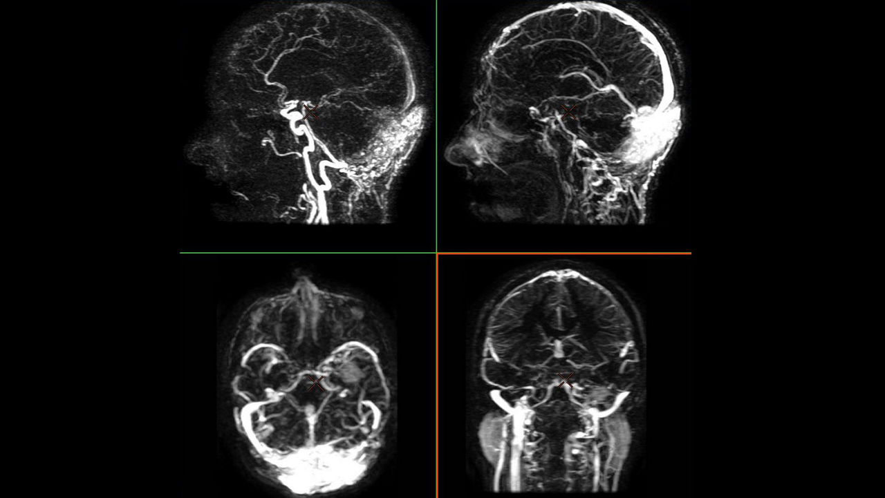 anced-visualization-applications-readyview-aw-readyview-clinical-image-advanced-ratio