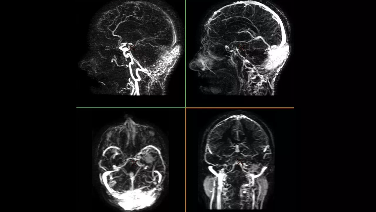anced-visualization-applications-readyview-aw-readyview-clinical-image-advanced-ratio