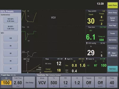 product-product-categories-anesthesia-delivery-aisys-cs2-aisys-cs2-tech-tab.jpg