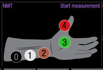 aoa-nmt-hookup-advisor-only-ci-en