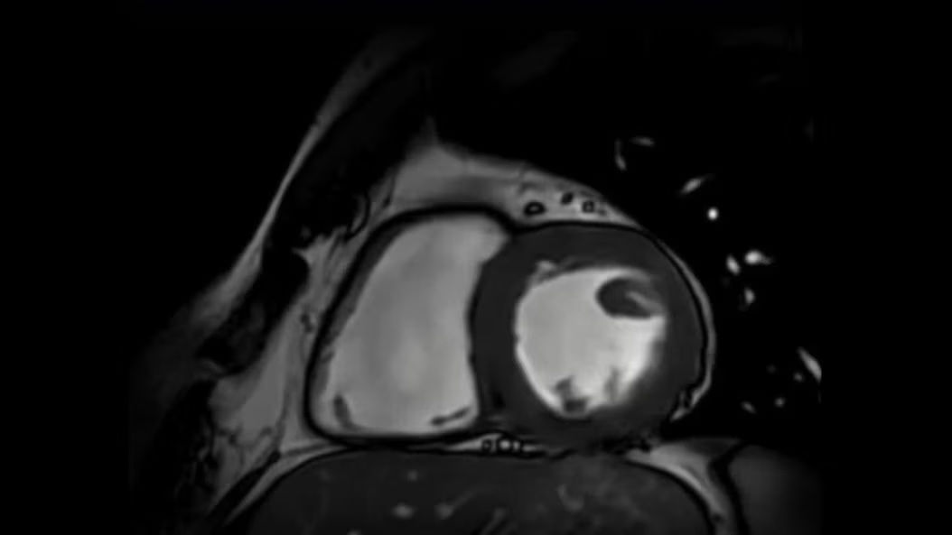 applications-cardioimaging-ci-en