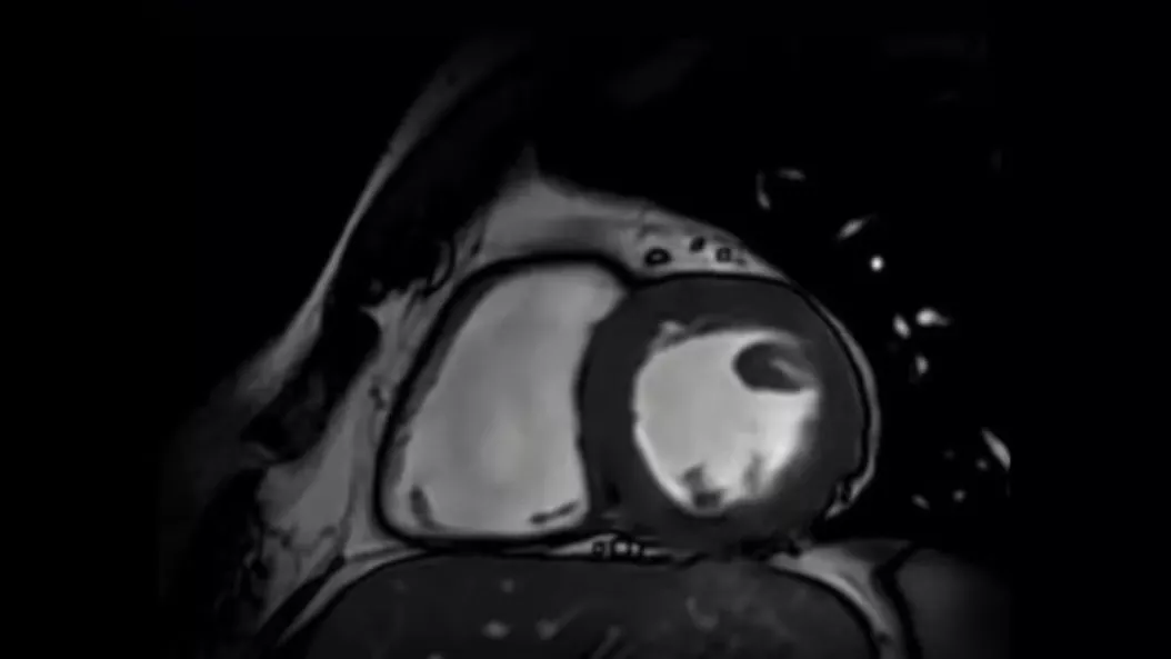 applications-cardioimaging-ci-en