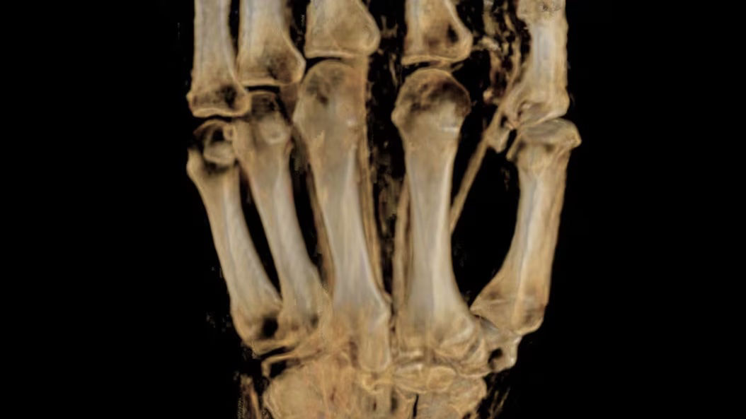 applications-msk-mri-ci-en