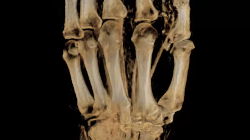 applications-msk-mri-ci-en