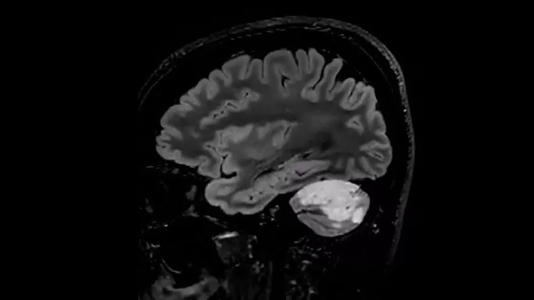 applications-onco-mri-ci-en