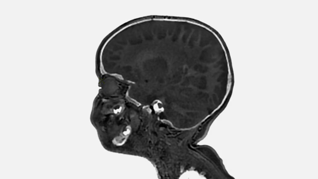 applications-pediatric-mri-ci-en