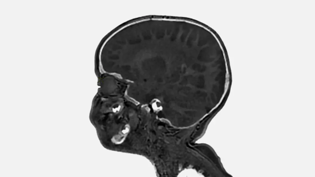 applications-pediatric-mri-ci-en