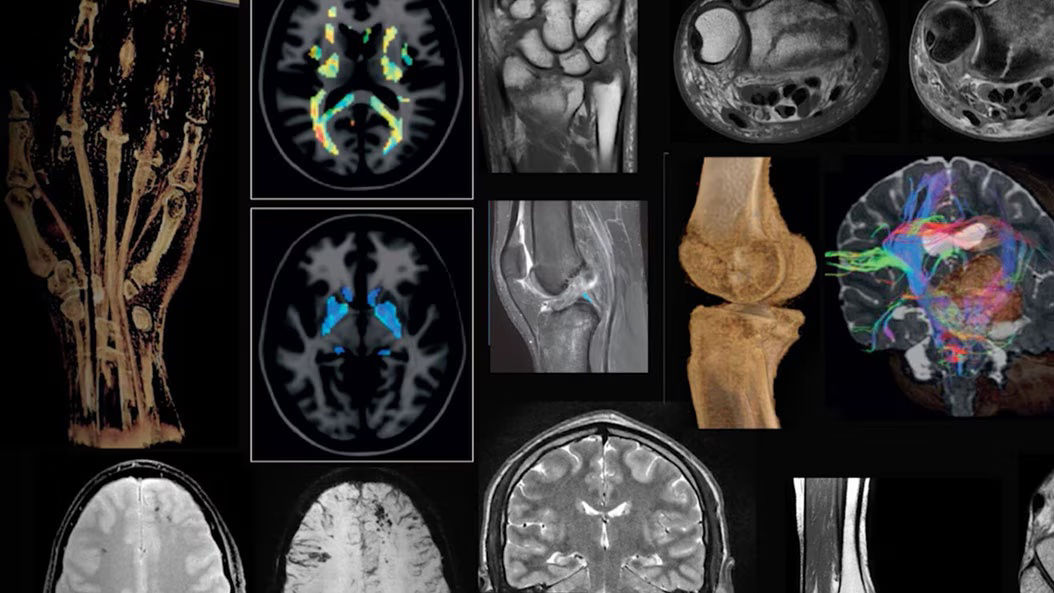 applications-sports-medicine-mri-ci-en