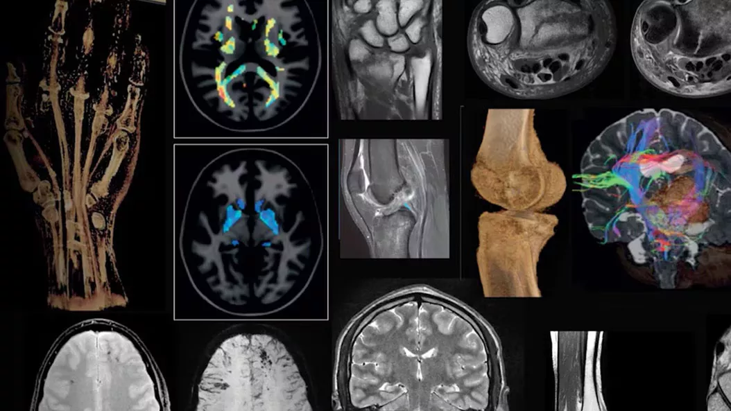 applications-sports-medicine-mri-ci-en