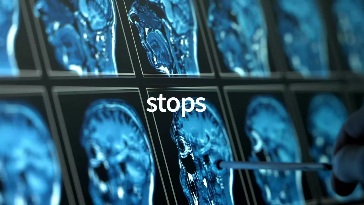 are-you-ready-for-altogether-better-mr-imaging