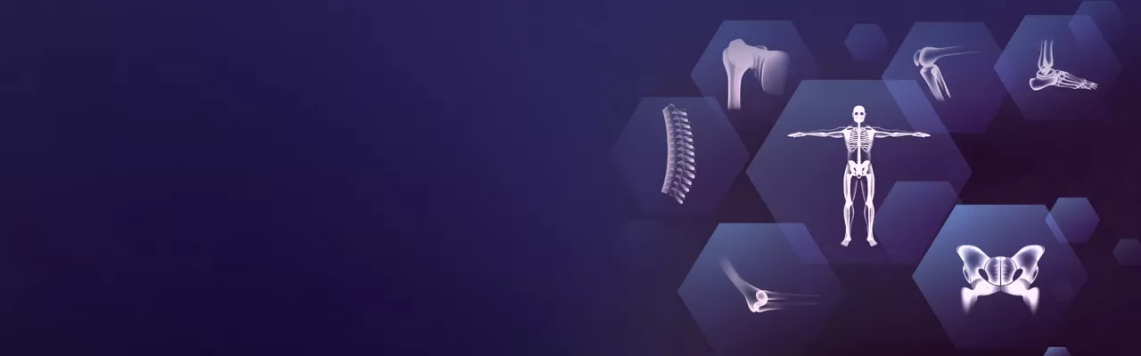 arms-for-orthopedics-PromoDynamicHighlight-ci-en